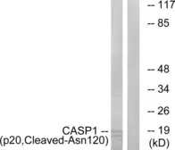 Anti-Caspase 1 (cleaved Asn120) antibody used in Western Blot (WB). GTX86897