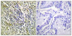 Anti-Aggrecan (cleaved Asp369) antibody used in IHC (Paraffin sections) (IHC-P). GTX86902