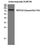 Anti-NOTCH2 (cleaved Ala1734) antibody used in Western Blot (WB). GTX86904