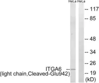 Anti-Integrin alpha 6 (cleaved Glu942) antibody used in Western Blot (WB). GTX86906