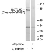 Anti-NOTCH2 (cleaved Val1697) antibody used in Western Blot (WB). GTX86911