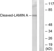 Anti-Lamin A (cleaved Asp230) antibody used in Western Blot (WB). GTX86913