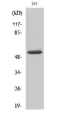 Anti-MMP14 (cleaved Tyr112) antibody used in Western Blot (WB). GTX86916