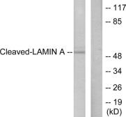 Anti-Lamin A (cleaved Asp230) antibody used in Western Blot (WB). GTX86918