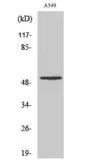 Anti-MMP17 (cleaved Gln129) antibody used in Western Blot (WB). GTX86926