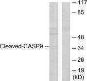 Anti-Caspase 9 (cleaved Asp330) antibody used in Western Blot (WB). GTX86928