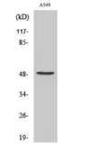 Anti-Factor X (cleaved Ala41) antibody used in Western Blot (WB). GTX86931