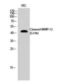 Anti-MMP12 (cleaved Glu106) antibody used in Western Blot (WB). GTX86934