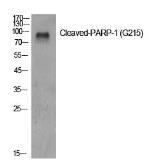 Anti-PARP (cleaved Gly215) antibody used in Western Blot (WB). GTX86935
