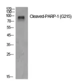Anti-PARP (cleaved Gly215) antibody used in Western Blot (WB). GTX86935