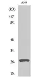 Anti-Cathepsin D (cleaved Leu169) antibody used in Western Blot (WB). GTX86942