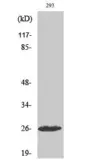 Anti-C1r (cleaved Ile464) antibody used in Western Blot (WB). GTX86944