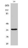 Anti-Caspase 9 (cleaved Asp315) antibody used in Western Blot (WB). GTX86945