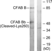 Anti-Factor B (cleaved Lys260) antibody used in Western Blot (WB). GTX86947