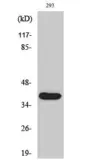 Anti-MMP23 (cleaved Tyr79) antibody used in Western Blot (WB). GTX86949