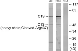 Anti-C1s (cleaved Arg437) antibody used in Western Blot (WB). GTX86953