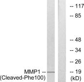Anti-MMP1 (cleaved Phe100) antibody used in Western Blot (WB). GTX86957