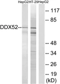 Anti-DDX52 antibody used in Western Blot (WB). GTX86965