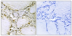 Anti-AMPD1 antibody used in IHC (Paraffin sections) (IHC-P). GTX86973