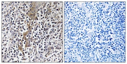 Anti-TMC8 antibody used in IHC (Paraffin sections) (IHC-P). GTX86980