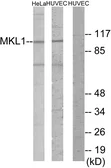 Anti-MKL1 antibody used in Western Blot (WB). GTX86986