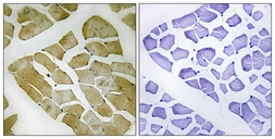 Anti-MYH4 antibody used in IHC (Paraffin sections) (IHC-P). GTX86988