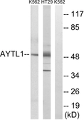 Anti-LPCAT2 antibody used in Western Blot (WB). GTX86989