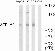 Anti-Sodium Potassium ATPase alpha 2 antibody used in Western Blot (WB). GTX87004