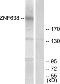 Anti-ZNF638 antibody used in Western Blot (WB). GTX87005