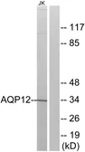 Anti-Aquaporin 12 antibody used in Western Blot (WB). GTX87006