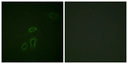 Anti-L1CAM antibody used in Immunocytochemistry/ Immunofluorescence (ICC/IF). GTX87010