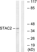 Anti-STAC2 antibody used in Western Blot (WB). GTX87012