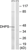 Anti-DHPS antibody used in Western Blot (WB). GTX87013