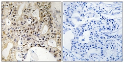 Anti-LATS1 + LATS2 antibody used in IHC (Paraffin sections) (IHC-P). GTX87014