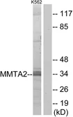 Anti-MMTAG2 antibody used in Western Blot (WB). GTX87017