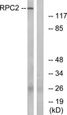 Anti-POLR3B antibody used in Western Blot (WB). GTX87020