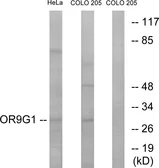 Anti-OR9G1 antibody used in Western Blot (WB). GTX87023