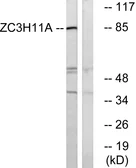 Anti-ZC3H11A antibody used in Western Blot (WB). GTX87024