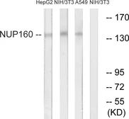 Anti-NUP160 antibody used in Western Blot (WB). GTX87027