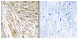 Anti-RPL22 antibody used in IHC (Paraffin sections) (IHC-P). GTX87028