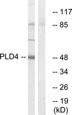 Anti-PLD4 antibody used in Western Blot (WB). GTX87031