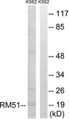 Anti-MRPL51 antibody used in Western Blot (WB). GTX87035