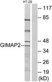 Anti-GIMAP2 antibody used in Western Blot (WB). GTX87040