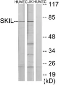 Anti-SnoN antibody used in Western Blot (WB). GTX87042