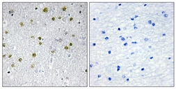 Anti-NRIP2 antibody used in IHC (Paraffin sections) (IHC-P). GTX87043