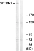 Anti-SPTBN1 antibody used in Western Blot (WB). GTX87047