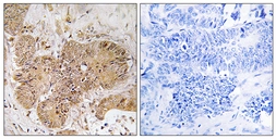 Anti-LUC7L2 antibody used in IHC (Paraffin sections) (IHC-P). GTX87049