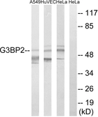 Anti-G3BP2 antibody used in Western Blot (WB). GTX87055