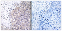Anti-POLG2 antibody used in IHC (Paraffin sections) (IHC-P). GTX87063