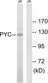 Anti-Pyruvate Carboxylase antibody used in Western Blot (WB). GTX87071
